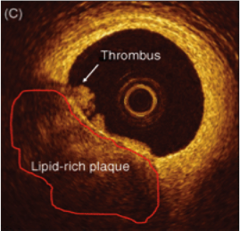 cardiology1