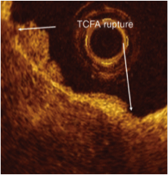 cardiology3