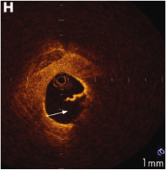 cardiology4