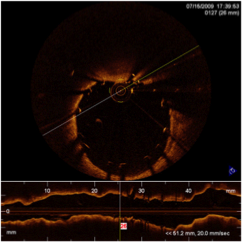 cardiology5