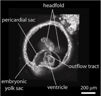 embryonic-heart2