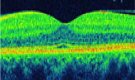 ophthalmology1