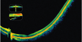 ophthalmology3