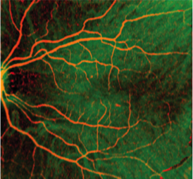 ophthalmology4